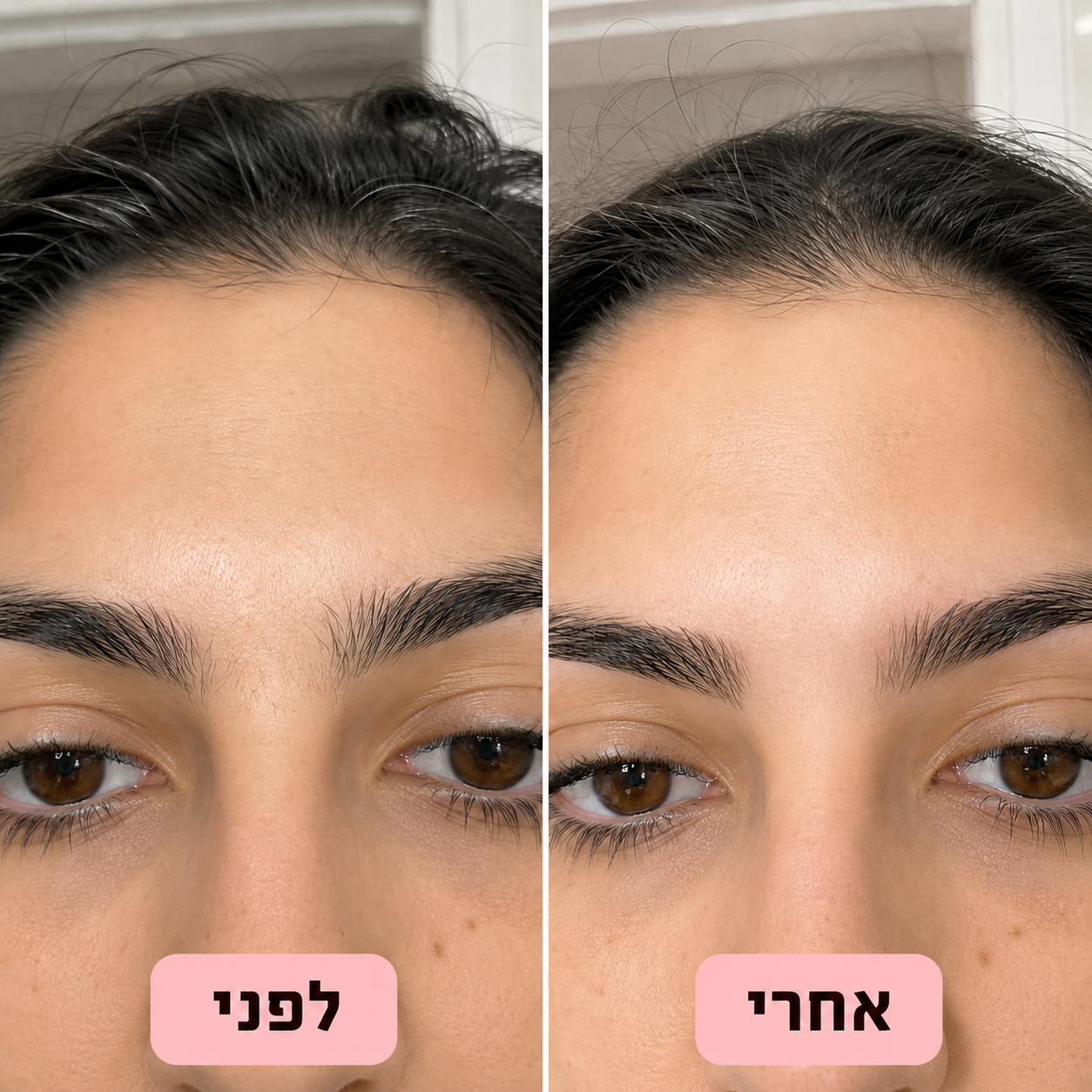 NIREL — מכונת גילוח קטנה ועדינה לפנים