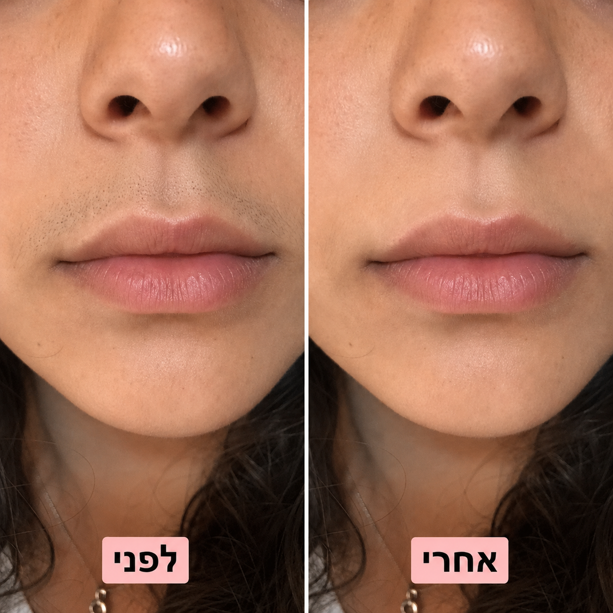 NIREL — מכונת גילוח קטנה ועדינה לפנים