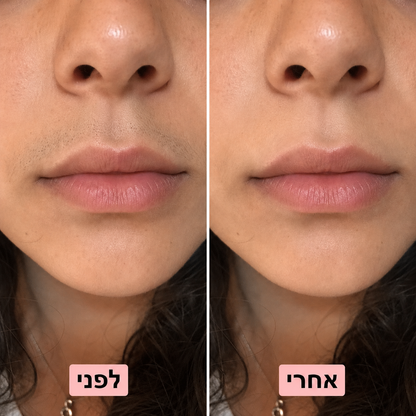 NIREL — מכונת גילוח קטנה ועדינה לפנים